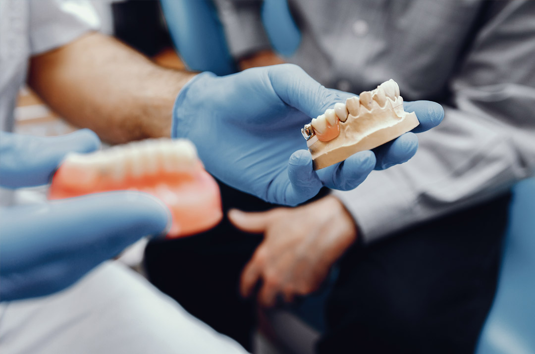 khối zirconia nha khoa để sử dụng phục hồi răng