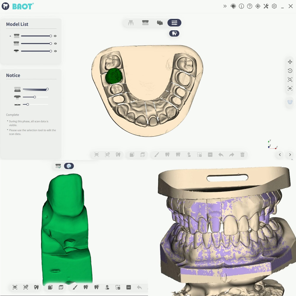 Máy Scan 3D nha khoa Scan hàm dưới