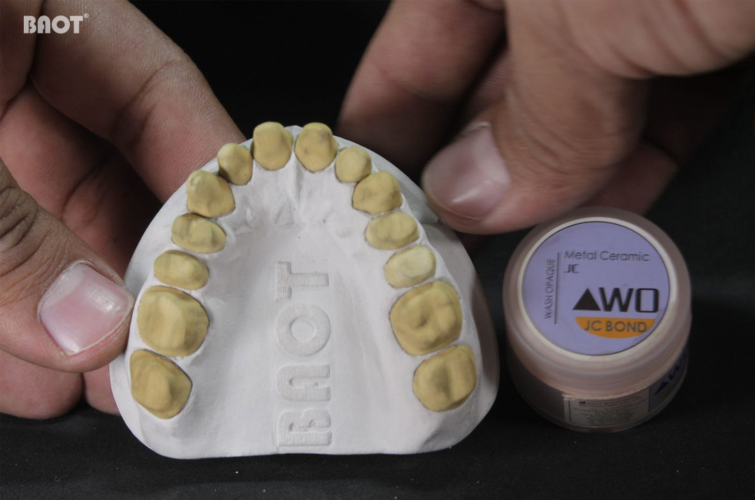 Làm thế nào để tránh phải làm lại trong quá trình phục hình răng