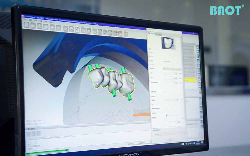 Vai trò của khối Zirconia trong tương lai của nha khoa kỹ thuật số